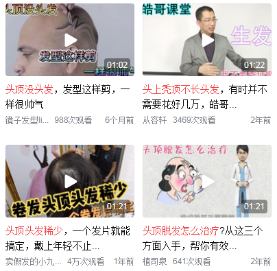头顶都没有头发怎么办