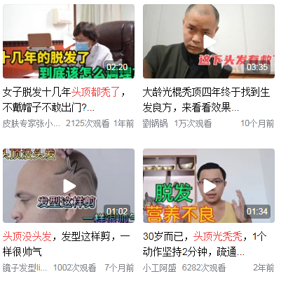 头顶都没有头发怎么办